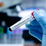 Malattie Sessualmente Trasmesse