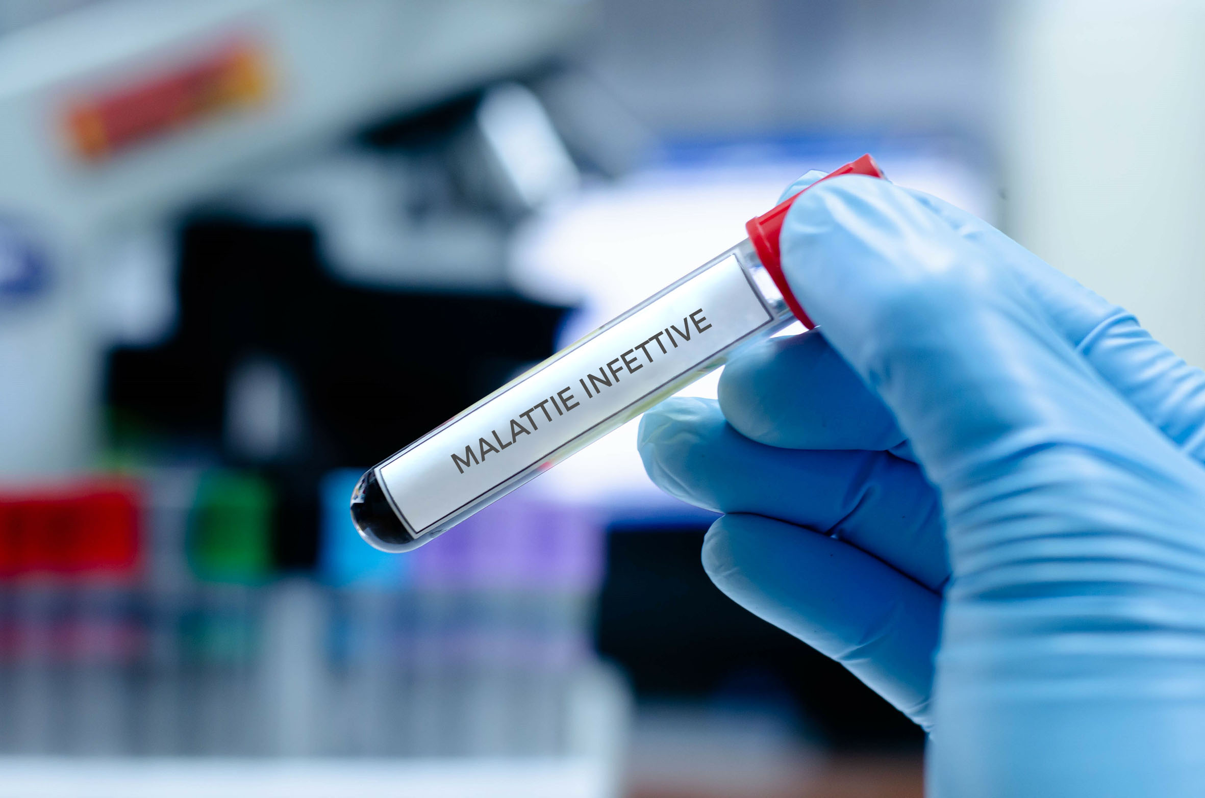 Malattie Sessualmente Trasmesse