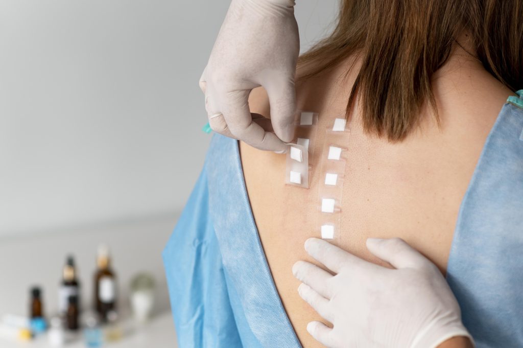 Patch test Patch test