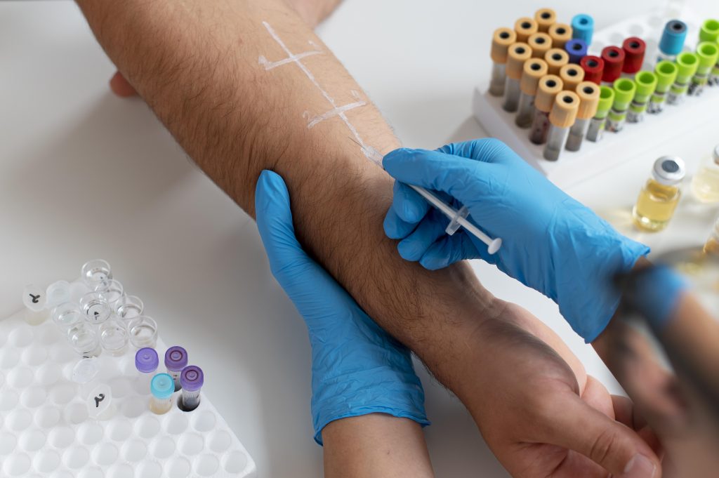 Prick Test Prick Test