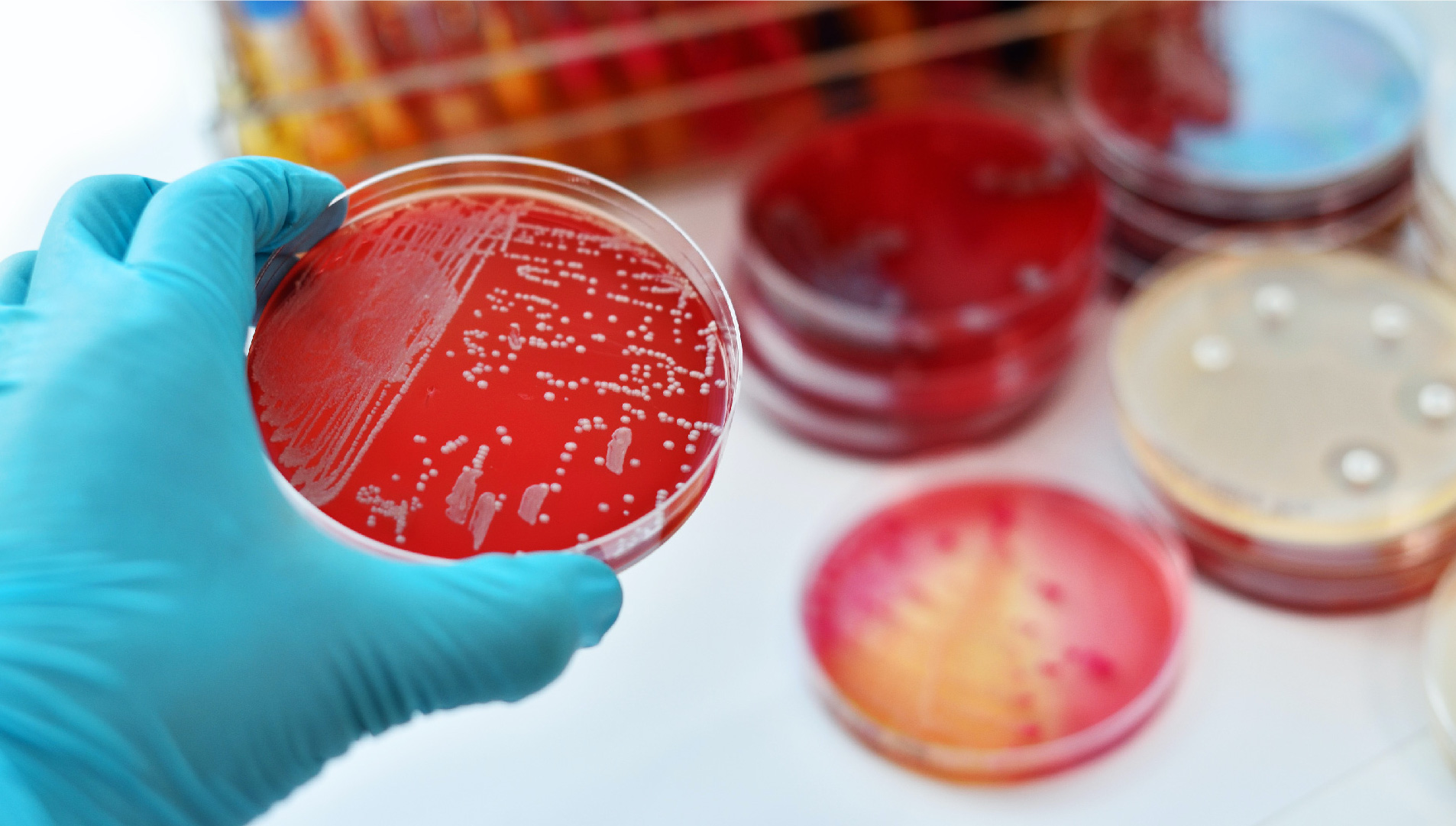 Sintomi infezioni vie urinarie e vaginali